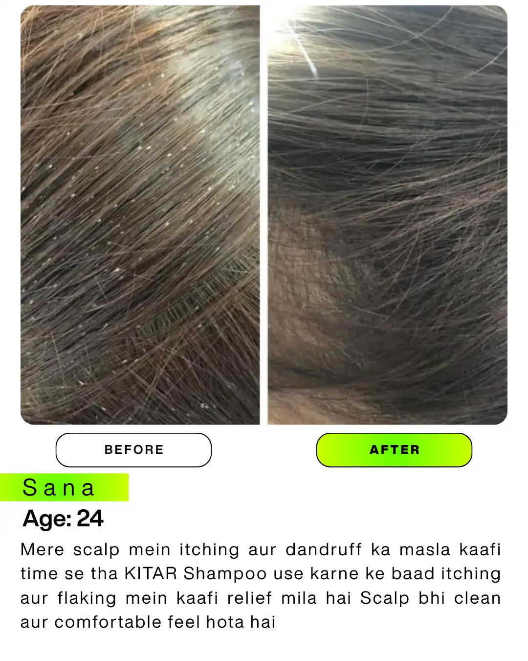 Instagram shop